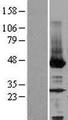 NEU2 / Sialidase 2 Protein - Western validation with an anti-DDK antibody * L: Control HEK293 lysate R: Over-expression lysate