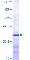 NEU2 / Sialidase 2 Protein - 12.5% SDS-PAGE Stained with Coomassie Blue.