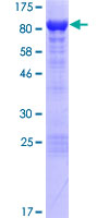 Neurochondrin Protein - 12.5% SDS-PAGE of human NCDN stained with Coomassie Blue