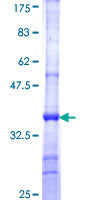 Neurochondrin Protein - 12.5% SDS-PAGE Stained with Coomassie Blue.