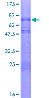NEUROD1 Protein - 12.5% SDS-PAGE of human NEUROD1 stained with Coomassie Blue