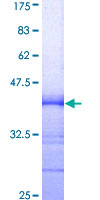 NEUROD1 Protein - 12.5% SDS-PAGE Stained with Coomassie Blue.