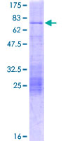 NEUROD2 Protein - 12.5% SDS-PAGE of human NEUROD2 stained with Coomassie Blue