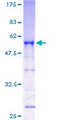 NEUROD4 Protein - 12.5% SDS-PAGE of human NEUROD4 stained with Coomassie Blue