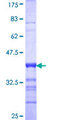 Neurofascin / NF Protein - 12.5% SDS-PAGE Stained with Coomassie Blue.