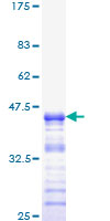 Neurofibromin / NF1 Protein - 12.5% SDS-PAGE Stained with Coomassie Blue.