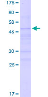NEUROG2 / NGN2 / Neurogenin 2 Protein - 12.5% SDS-PAGE of human NEUROG2 stained with Coomassie Blue