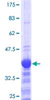 NEUROG2 / NGN2 / Neurogenin 2 Protein - 12.5% SDS-PAGE Stained with Coomassie Blue.