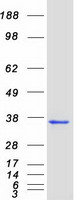 NEUROG3 / NGN3 / Neurogenin 3 Protein - Purified recombinant protein NEUROG3 was analyzed by SDS-PAGE gel and Coomassie Blue Staining