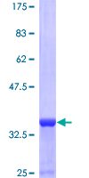Neuropeptide Y / NPY Protein - 12.5% SDS-PAGE of human NPY stained with Coomassie Blue