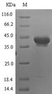 Neurotrypsin Protein - (Tris-Glycine gel) Discontinuous SDS-PAGE (reduced) with 5% enrichment gel and 15% separation gel.
