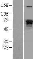 NF-L / NEFL Protein - Western validation with an anti-DDK antibody * L: Control HEK293 lysate R: Over-expression lysate