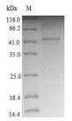 NF-L / NEFL Protein - (Tris-Glycine gel) Discontinuous SDS-PAGE (reduced) with 5% enrichment gel and 15% separation gel.