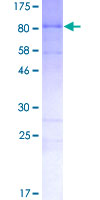 NF-L / NEFL Protein - 12.5% SDS-PAGE of human NEFL stained with Coomassie Blue