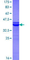 NF1A / NFIX Protein - 12.5% SDS-PAGE Stained with Coomassie Blue.