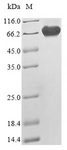 NF2 / Merlin Protein - (Tris-Glycine gel) Discontinuous SDS-PAGE (reduced) with 5% enrichment gel and 15% separation gel.
