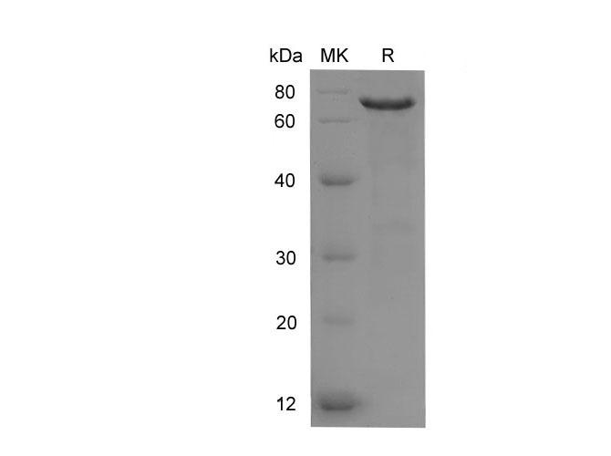 NF2 / Merlin Protein - Recombinant Human Merlin/NF2 protein (His Tag)