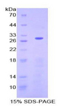 NF2 / Merlin Protein - Recombinant Neurofibromin 2 By SDS-PAGE
