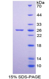 NF90 / ILF3 Protein - Recombinant Interleukin Enhancer Binding Factor 3 By SDS-PAGE
