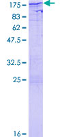 NFAT4 / NFATC3 Protein - 12.5% SDS-PAGE of human NFATC3 stained with Coomassie Blue