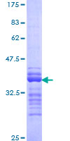 NFAT4 / NFATC3 Protein - 12.5% SDS-PAGE Stained with Coomassie Blue.