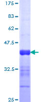 NFAT5 Protein - 12.5% SDS-PAGE Stained with Coomassie Blue.