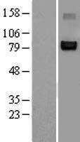 NFATC1 / NFAT2 Protein - Western validation with an anti-DDK antibody * L: Control HEK293 lysate R: Over-expression lysate