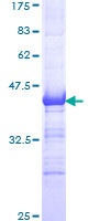 NFATC1 / NFAT2 Protein - 12.5% SDS-PAGE Stained with Coomassie Blue.