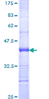 NFATC4 / NFAT3 Protein - 12.5% SDS-PAGE Stained with Coomassie Blue.