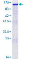 NFE2L2 / NRF2 Protein - 12.5% SDS-PAGE of human NFE2L2 stained with Coomassie Blue