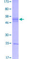 NFE2L2 / NRF2 Protein - 12.5% SDS-PAGE Stained with Coomassie Blue.
