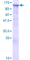 NFE2L3 Protein - 12.5% SDS-PAGE of human NFE2L3 stained with Coomassie Blue
