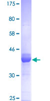 NFI / NFIC Protein - 12.5% SDS-PAGE Stained with Coomassie Blue.