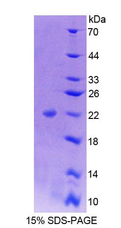 NFIA / Nuclear Factor 1 Protein - Recombinant Nuclear Factor I/A By SDS-PAGE