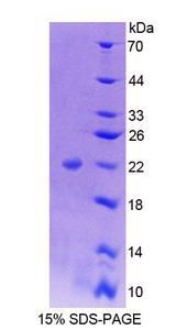 NFIA / Nuclear Factor 1 Protein - Recombinant Nuclear Factor I/A By SDS-PAGE