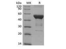 NFKB1 / NF-Kappa-B Protein - Recombinant Human NFKB1 (N-6His)