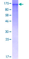 NFKB1 / NF-Kappa-B Protein - 12.5% SDS-PAGE of human NFKB1 stained with Coomassie Blue