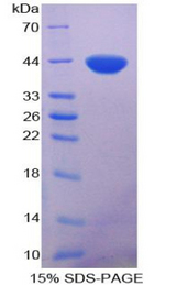 NFKB1 / NF-Kappa-B Protein - Recombinant Nuclear Factor Kappa B By SDS-PAGE