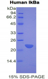 NFKBIA / IKB Alpha / IKBA Protein - Recombinant Inhibitory Subunit Of NF Kappa B Alpha By SDS-PAGE