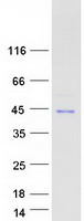 NFKBIA / IKB Alpha / IKBA Protein - Purified recombinant protein NFKBIA was analyzed by SDS-PAGE gel and Coomassie Blue Staining