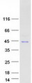 NFKBIA / IKB Alpha / IKBA Protein - Purified recombinant protein NFKBIA was analyzed by SDS-PAGE gel and Coomassie Blue Staining