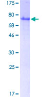 NFKBIB / IKB Beta / IKBB Protein - 12.5% SDS-PAGE of human NFKBIB stained with Coomassie Blue