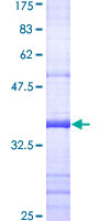 NFKBIB / IKB Beta / IKBB Protein - 12.5% SDS-PAGE Stained with Coomassie Blue.