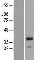 NFKBID / IkappaBNS Protein - Western validation with an anti-DDK antibody * L: Control HEK293 lysate R: Over-expression lysate