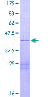 NFKBID / IkappaBNS Protein - 12.5% SDS-PAGE of human TA-NFKBH stained with Coomassie Blue