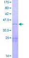 NFKBID / IkappaBNS Protein - 12.5% SDS-PAGE of human TA-NFKBH stained with Coomassie Blue