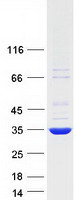 NFKBID / IkappaBNS Protein - Purified recombinant protein NFKBID was analyzed by SDS-PAGE gel and Coomassie Blue Staining