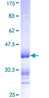 NFKBIE / IKB Epsilon Protein - 12.5% SDS-PAGE Stained with Coomassie Blue.