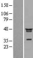 NFKBIL1 Protein - Western validation with an anti-DDK antibody * L: Control HEK293 lysate R: Over-expression lysate