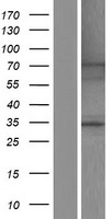 NFKBIZ / IKBZ Protein - Western validation with an anti-DDK antibody * L: Control HEK293 lysate R: Over-expression lysate